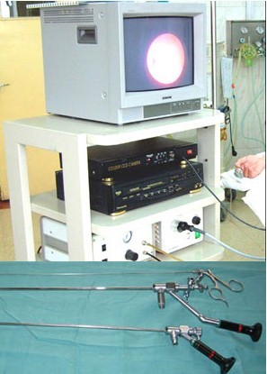 德國WOLF輸卵管鏡